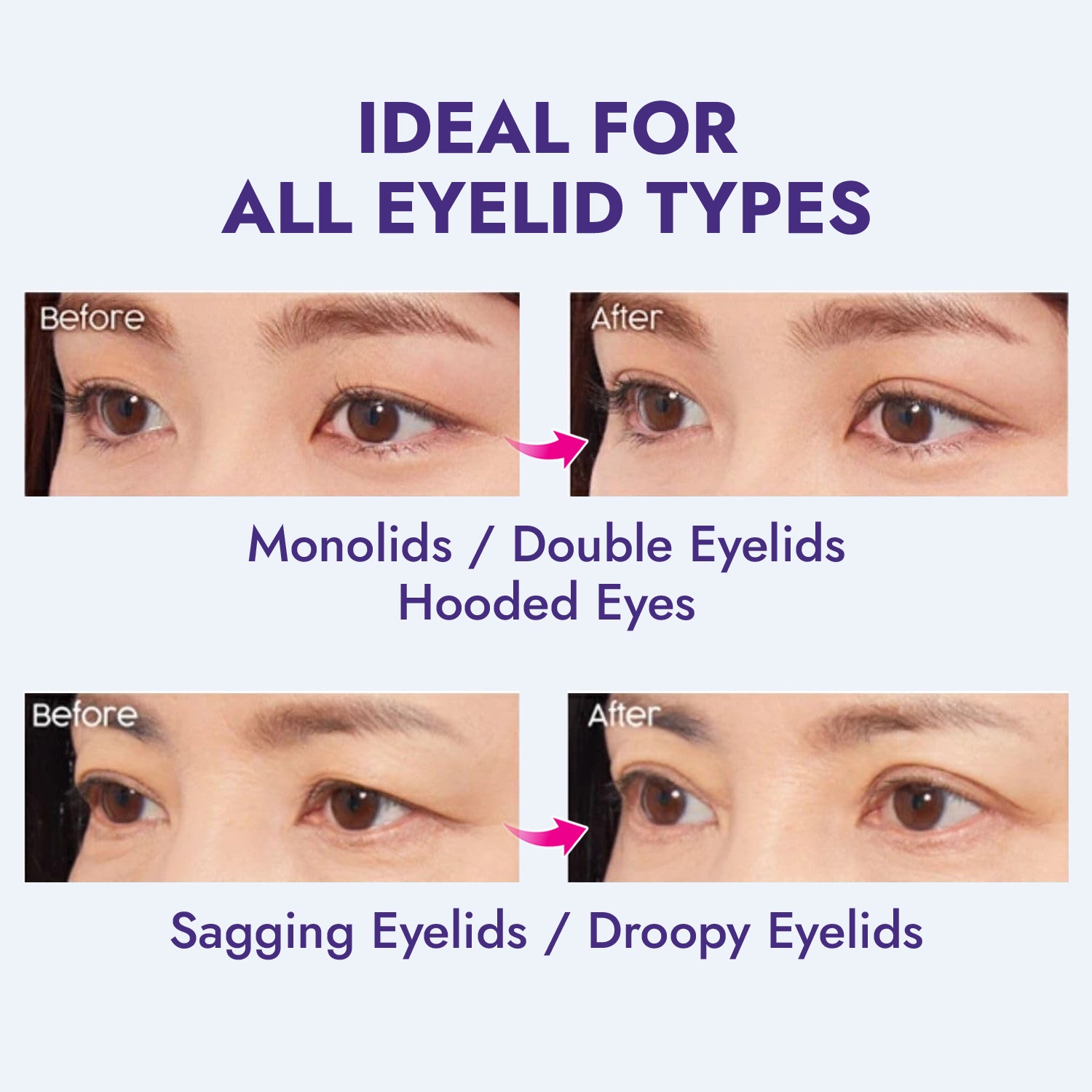 Before and after comparison of eyelid types with text indicating product suitability for various eye shapes.